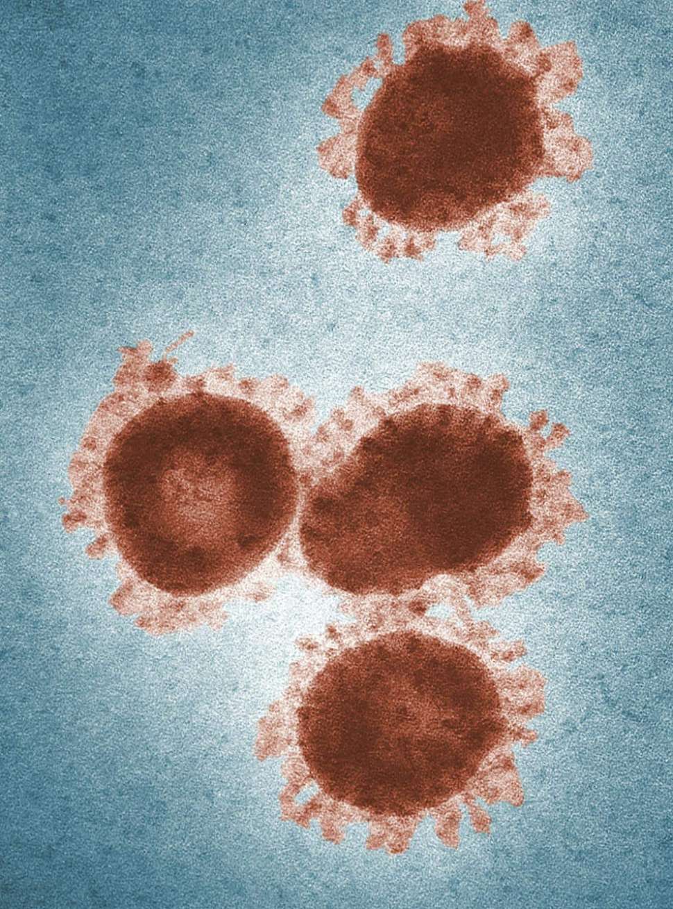 virus-pexels-generic.jpg