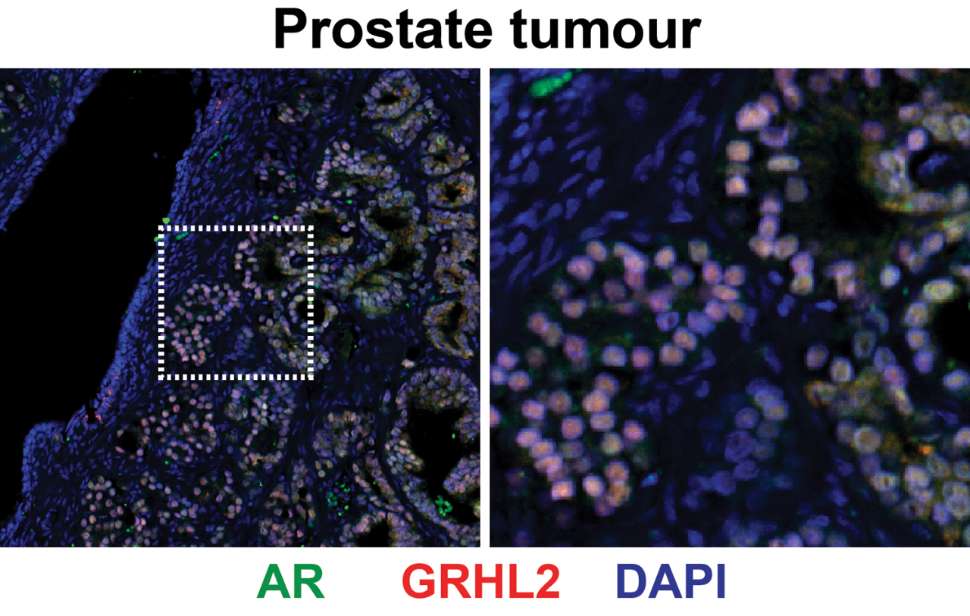 prostate-cancer-image-research.jpg